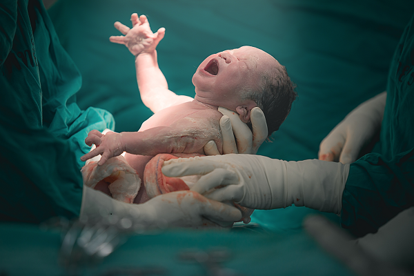 New born baby being held by medical professionals in green gowns with gloves.